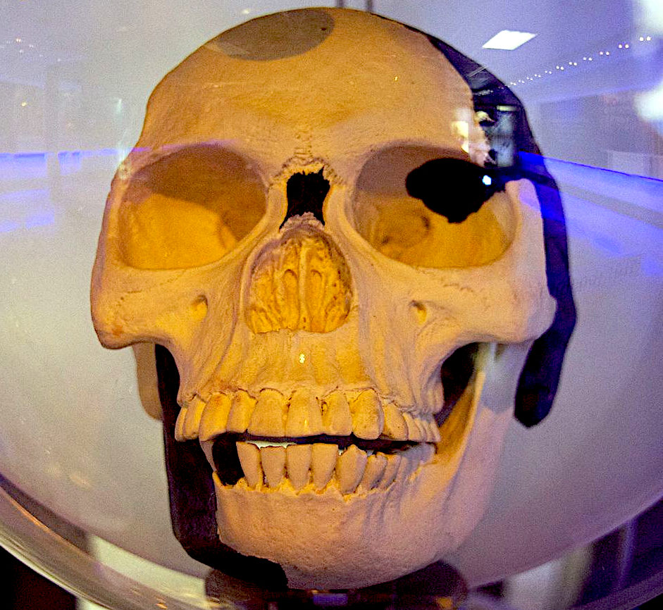 Piltdown Man skull